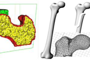 banner-densitometria-osea